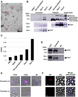 <mark class="highlighted">Malaria Parasites</mark> Hijack Host Receptors From Exosomes to Capture Lipoproteins